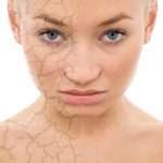 Причины сухой кожи лица. Косметика для сухой кожи лица