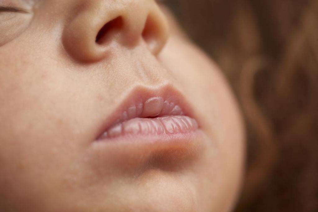 Обветренные губы у детей